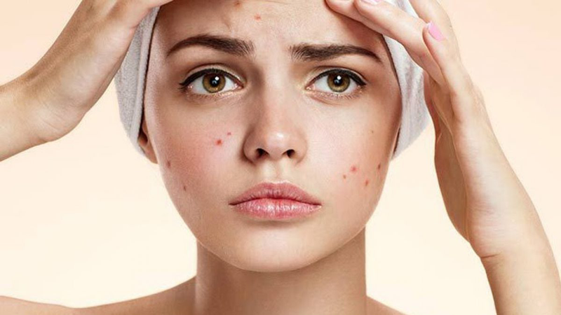Ăn bắp có nổi mụn không? Những lợi ích khi ăn bắp? 3